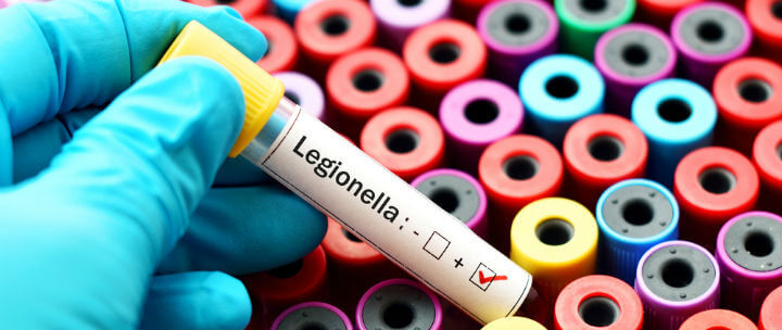 legionella